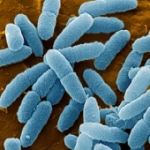 Bactérias no espaço crescem de forma estranha
