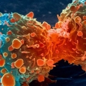 Cancro: factos e sintomas