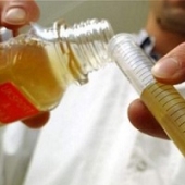 Descoberta toda a composição química da urina