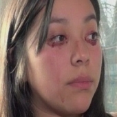 Mulher chilena chora sangue (com video)